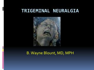 Trigeminal Neuralgia