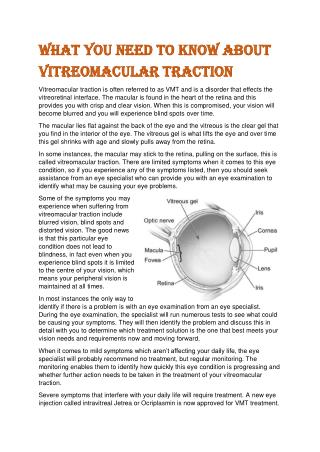 What You Need to Know About Vitreomacular Traction