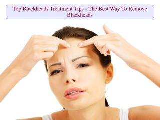 Top Blackheads Treatment Tips - The Best Way To Remove Blackheads