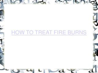 How To Treat Fire Burn