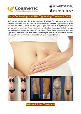 Body Contouring and Skin Tightening Treatment In Delhi