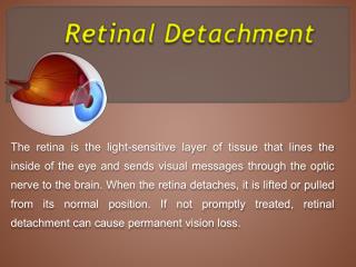 Retinal detachment