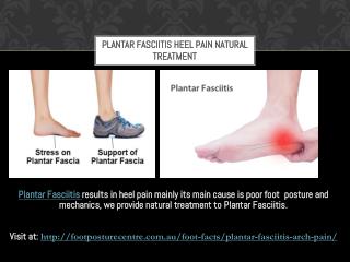 Plantar Fasciitis