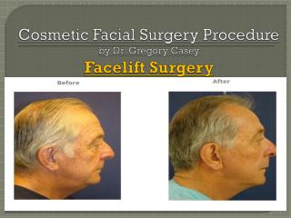 Facelift Surgery - Dr Gregory Casey