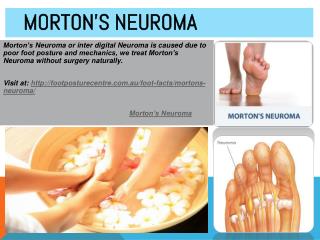 Morton's Neuroma