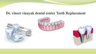 Dr vineet vinayak dental center Teeth Replacement Options