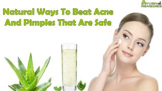 Natural Ways To Beat Acne And Pimples That Are Safe