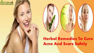 Herbal Remedies To Cure Acne And Scars Safely