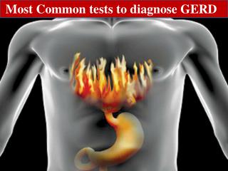 Most Common tests to diagnose GERD