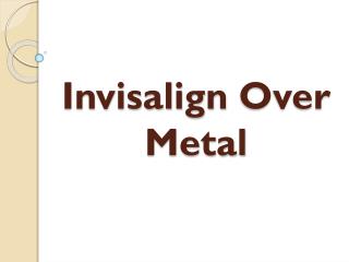 Invisalign Over Metal