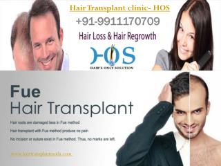 Hair Transplant clinic- HOS 9911170709