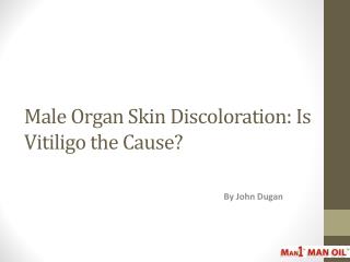 Male Organ Skin Discoloration: Is Vitiligo the Cause?