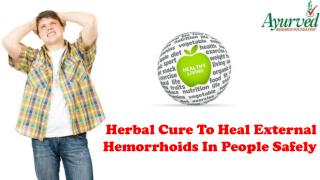 Herbal Cure To Heal External Hemorrhoids In People Safely