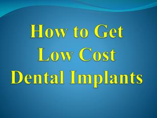 How to Get Low Cost Dental Implants