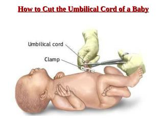 How to Cut the Umbilical Cord of a Baby