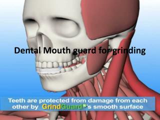 prevents teeth grinding