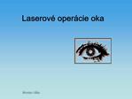 Laserov oper cie oka