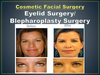 Eyelid Surgery –Dr. Gregory Casey