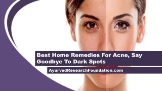 Best Home Remedies For Acne, Say Goodbye To Dark Spots