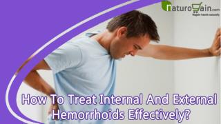 How To Treat Internal And External Hemorrhoids Effectively?