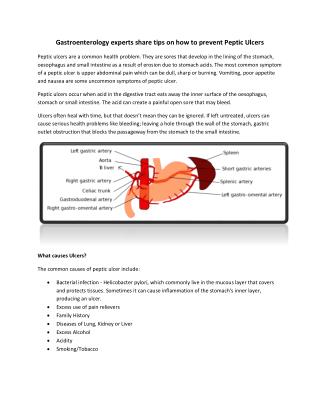 Gastroenterology Experts share Tips on how to Prevent Peptic Ulcers