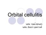 Orbital cellulitis