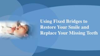 Using Fixed Bridges To Restore Your Smile And Replace Your Missing Teeth