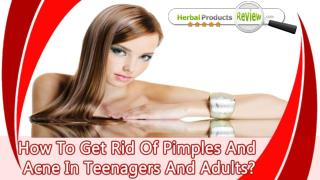 How To Get Rid Of Pimples And Acne In Teenagers And Adults?