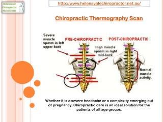 Chiropractic Thermography Scan