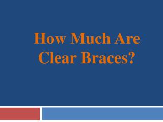 How Much Are Clear Braces?