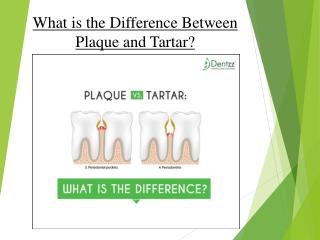 What is the Difference Between Plaque and Tartar