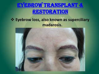 Eyebrow Transplant & Restoration | Eyebrow Hair Transplant