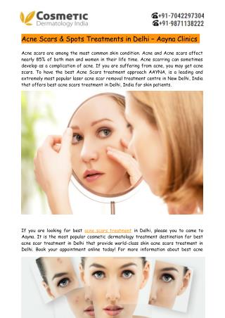 Best Acne Scars & Spots Treatment in Delhi