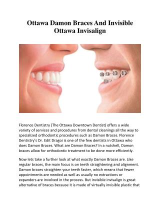 Ottawa Damon Braces And Invisible Ottawa Invisalign