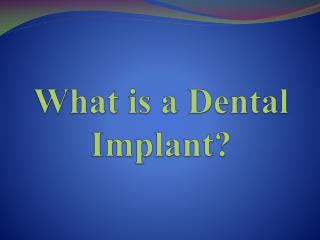 What is a Dental Implant?