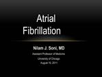 Atrial Fibrillation