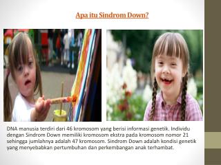 Apa itu Sindrom Down
