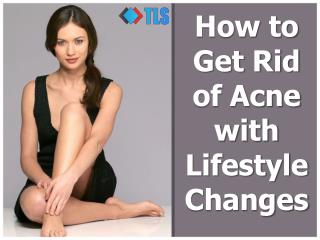 How To Get Rid Of Acne With Simple Lifestyle Changes