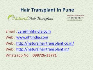 Hair Transplant Surgery in Pune, India at low cost..