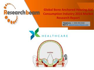Global Bone Anchored Hearing Aid Consumption Industry 2016