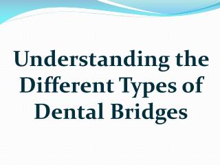 Understanding the Different Types of Dental Bridges