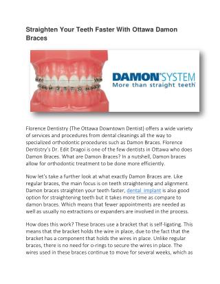 Straighten Your Teeth Faster With Ottawa Damon Braces