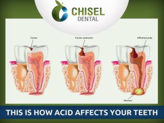 This is How Acid affects your Teeth