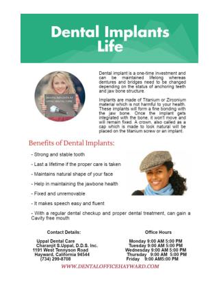 Dental Implant in Hayward by Implant Dentist Dr. Uppal