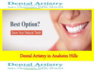 Dental Implant Orange County