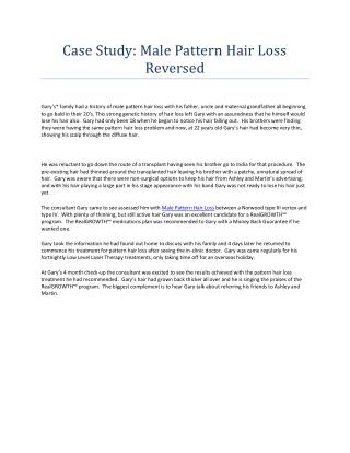 Case Study: Male Pattern Hair Loss Reversed