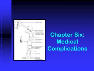 Chapter Six: Medical Complications