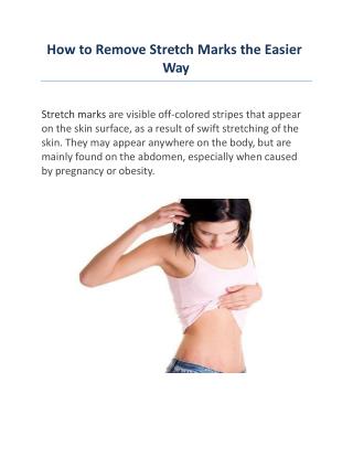 How to Remove Stretch Marks