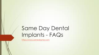 SameDay Dental Implants - FAQs