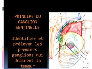 PRINCIPE DU GANGLION SENTINELLE Identifier et prélever les premiers ganglions qui drainent la tumeur